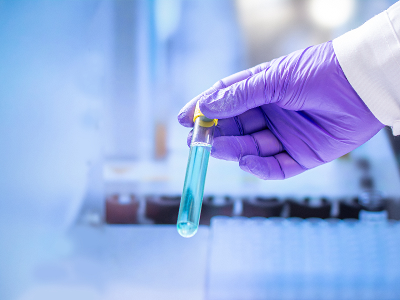 Illustration. (Photo : medcom.id)