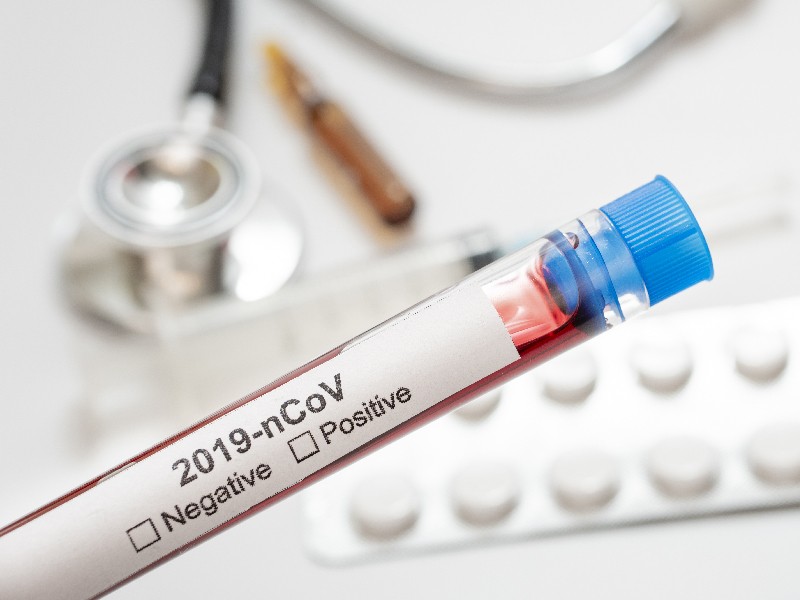 Illustration. (Photo : medcom.id)